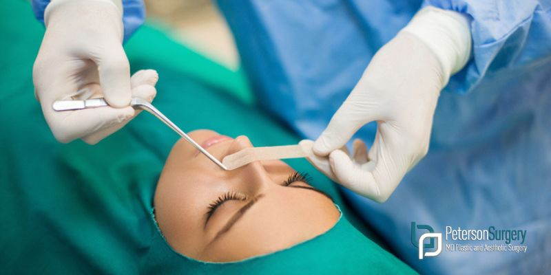 Am I A Good Candidate For Nasal Surgery?